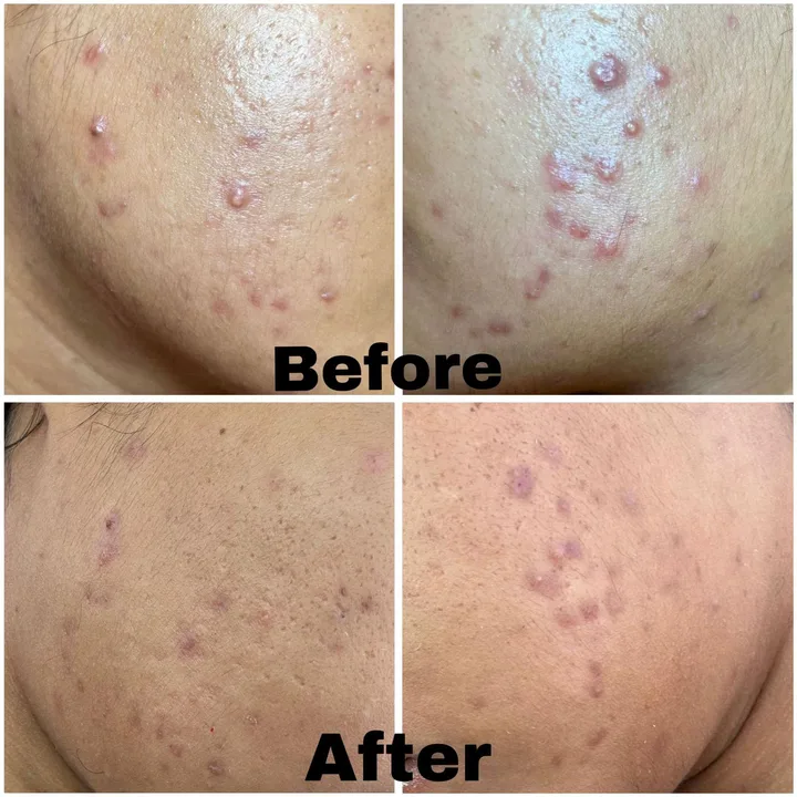 M-Plified Beauty client review or treatment result 1