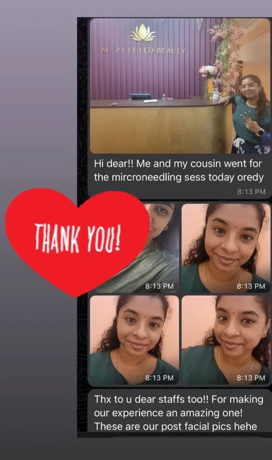 M-Plified Beauty client review or treatment result 11