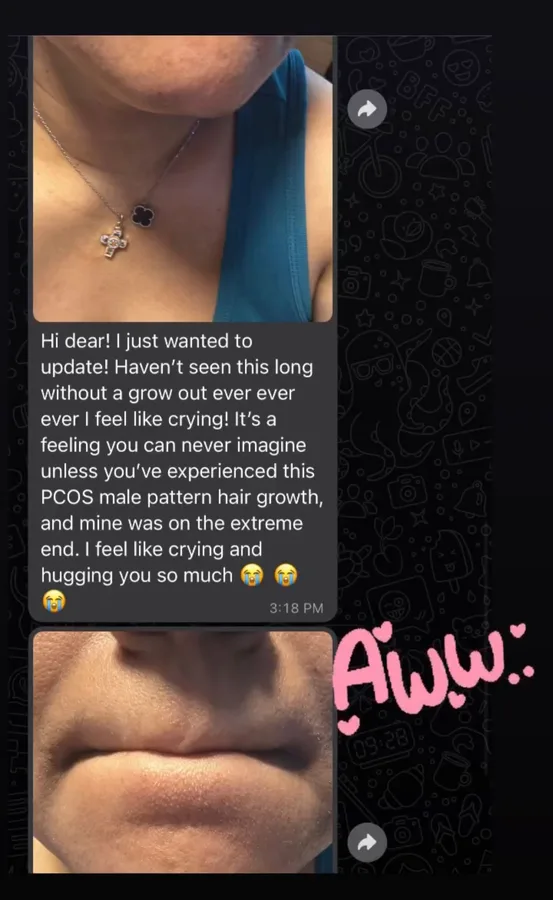 M-Plified Beauty client review or treatment result 12