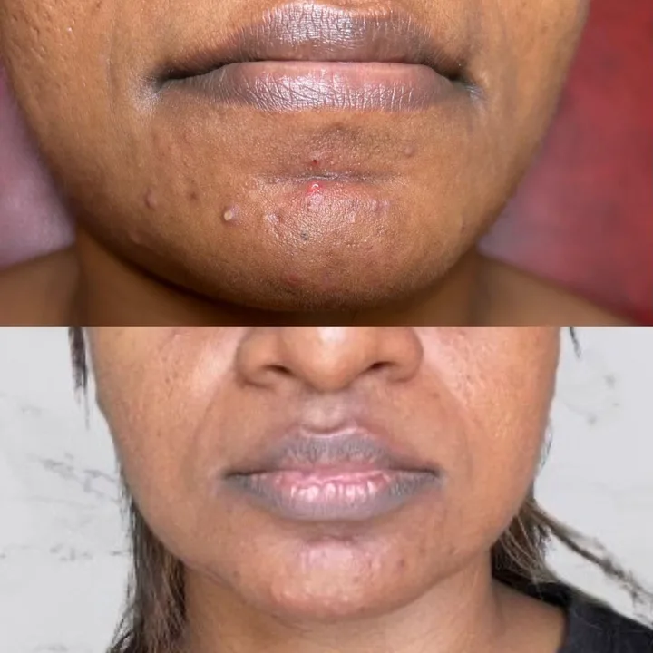 M-Plified Beauty client review or treatment result 3
