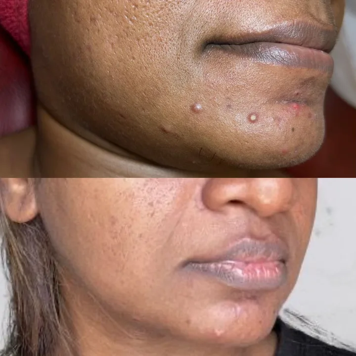 M-Plified Beauty client review or treatment result 4