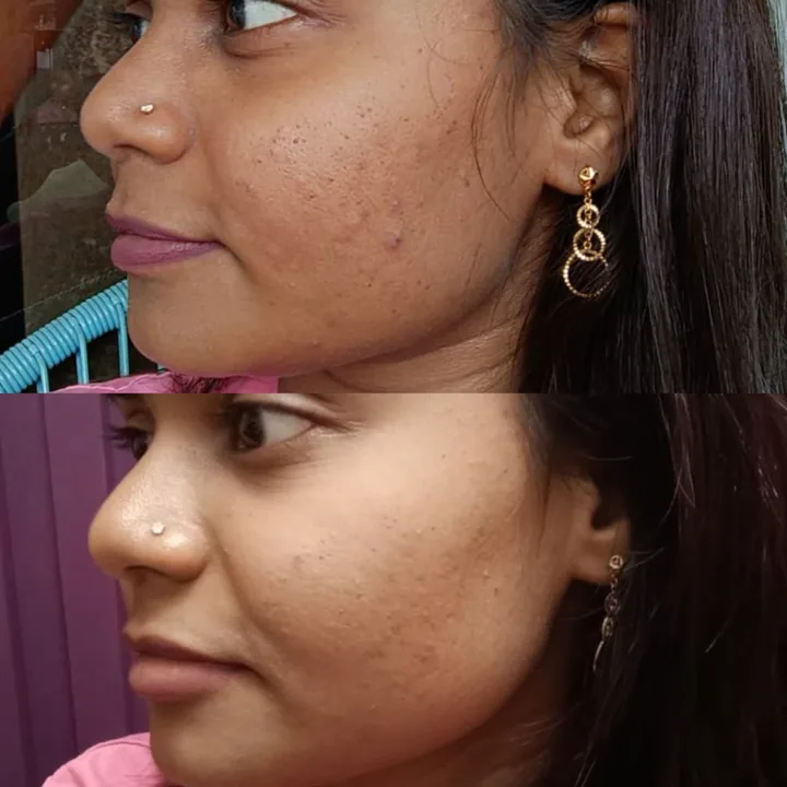 M-Plified Beauty client review or treatment result 5