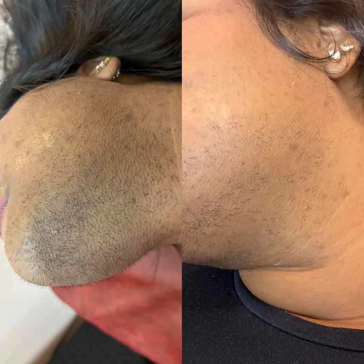 M-Plified Beauty client review or treatment result 6