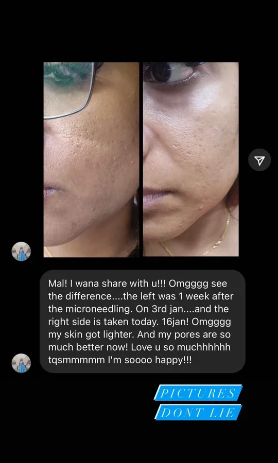 M-Plified Beauty client review or treatment result 7