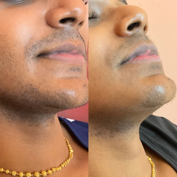 M-Plified Beauty client review or treatment result 8