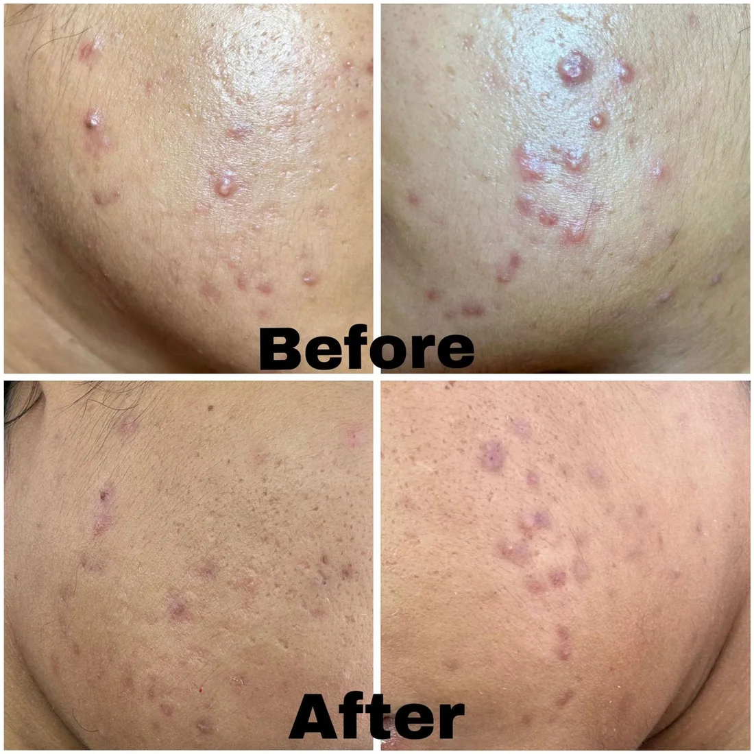 Facial client result 1