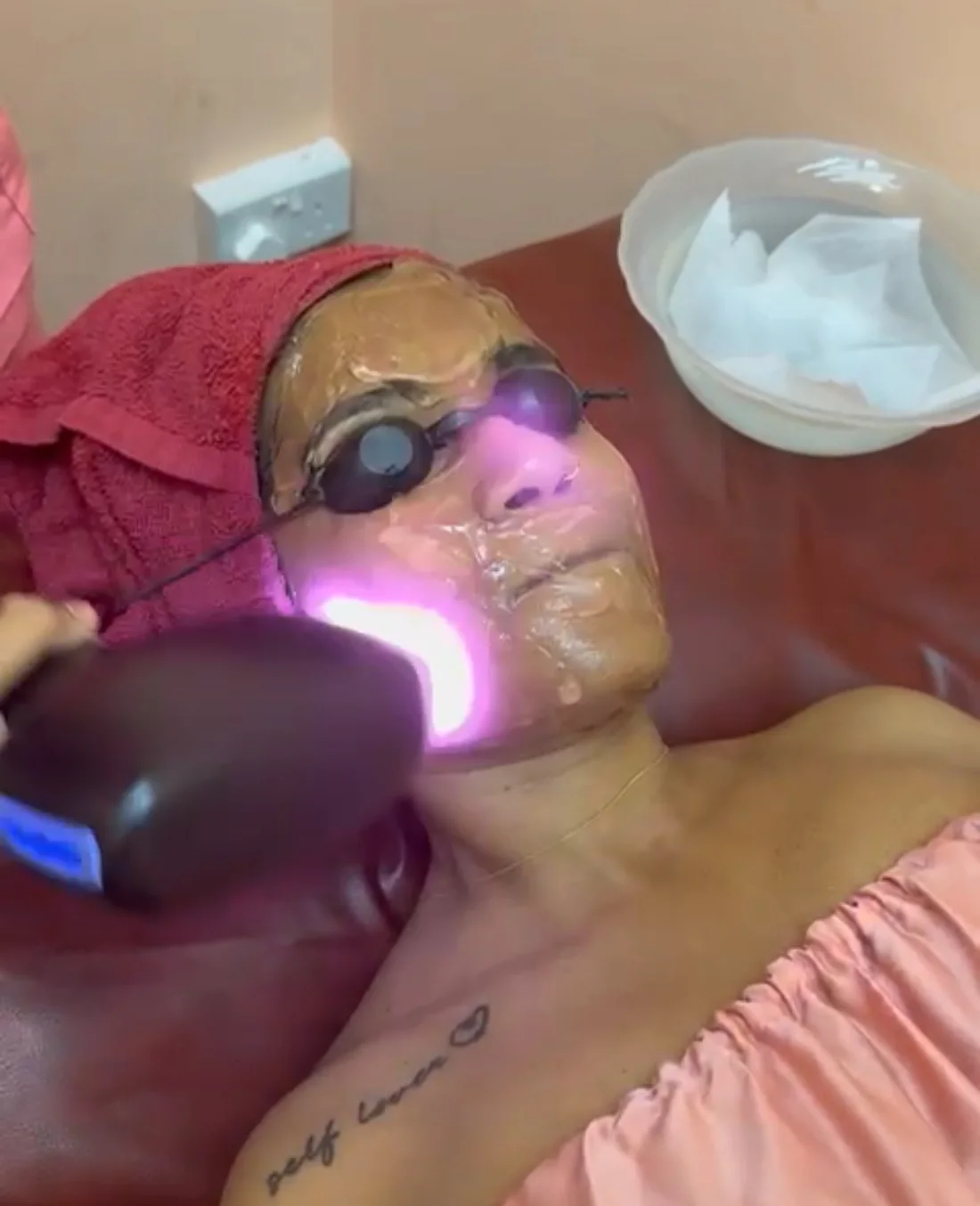 SHR laser hair reduction treatment at M-Plified Beauty Singapore